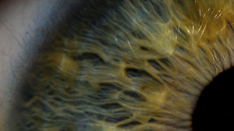 eye-pupil-cropped