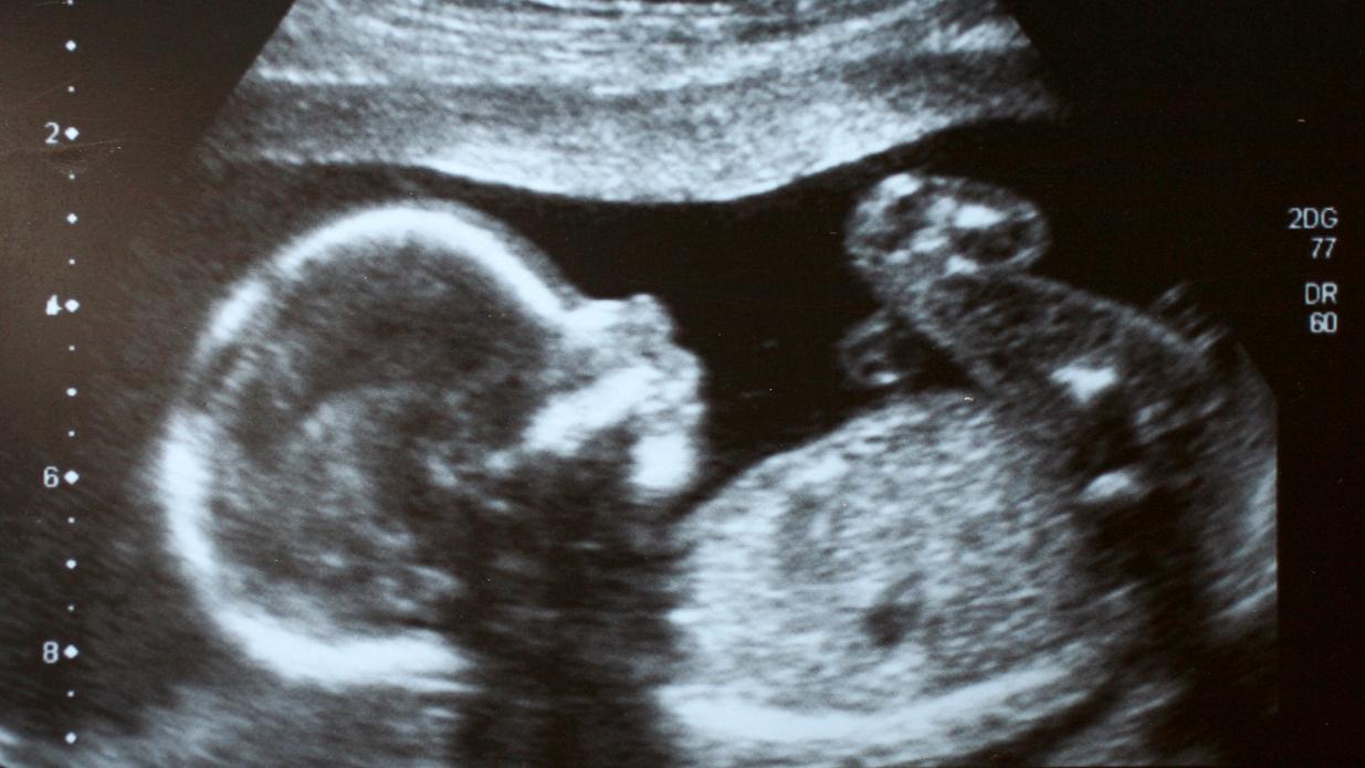 15. týždeň tehotenstva: Ukecané baby? Dievčatká v maternici podľa štúdií  hýbu ústami viac, než chlapci - Tehotenstvo | Najmama.sk