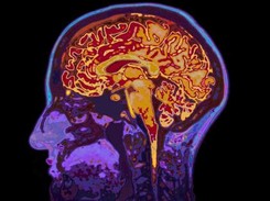 Człowiek łączy się maszyną. Co nas czeka w epoce transhumanizmu?