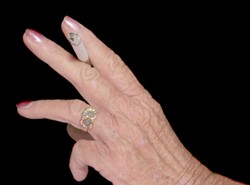 Bolesne i nieuleczalne zapalenie stawów? Przez papierosy!