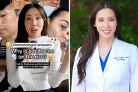 Coraz więcej dorosłych zmaga się z trądzikiem. Dermatolożka podpowiada, jak z nim walczyć