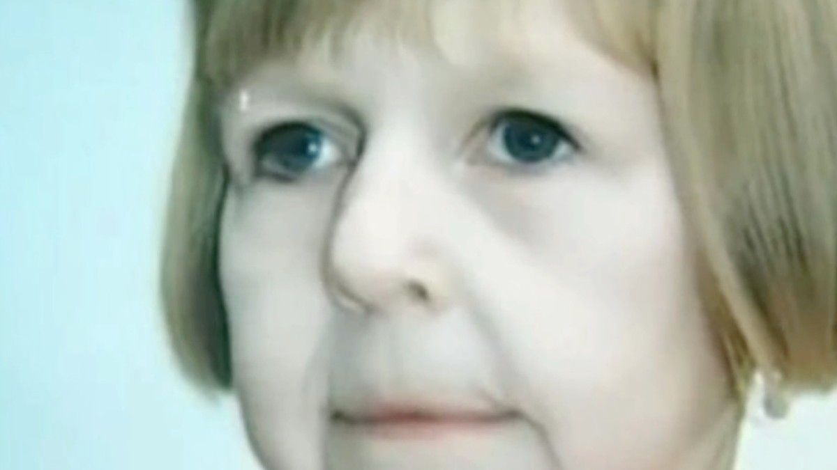 Katja je rođena sa licem starice, muž je tukao i javno je ponizio