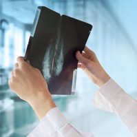 Emlőrák: ez a tünet téveszti meg leggyakrabban a nőket