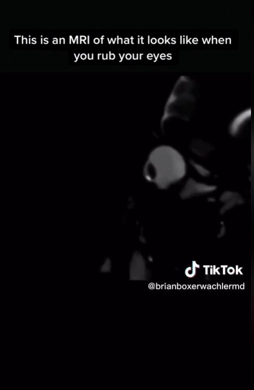 Video z magnetickej rezonancie.