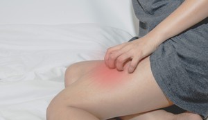 Tipične zone zimskog svraba su: unutrašnja strana butina, iznad i iza kolena, listovi i oko članaka