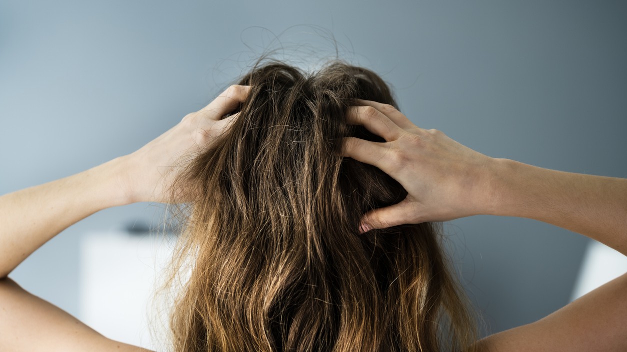 Čo signalizuje suchá pokožka hlavy?