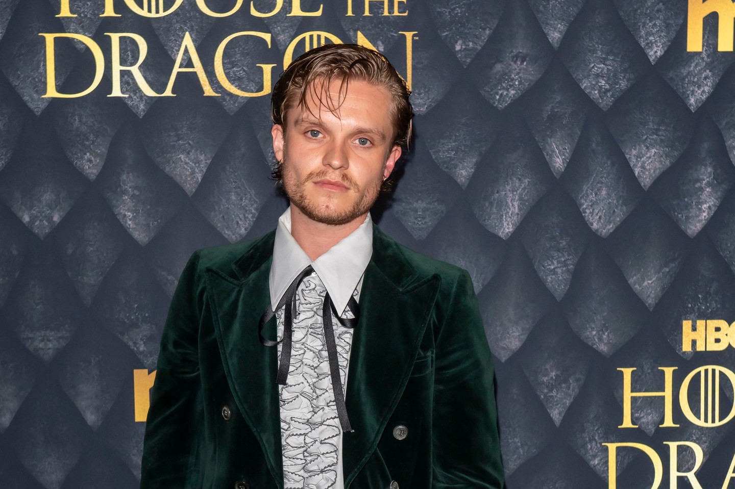 Gondoltad volna, hogy ilyen jóképű ez a végtelenül antipatikus karakter?