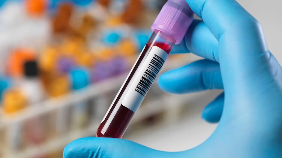 Nalazi krvi pokazali da je loše