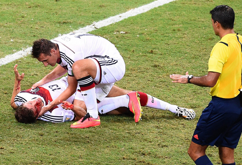 Krwawe zakończenie meczu Niemcy - Ghana. Thomas Mueller mocno ucierpiał. ZDJĘCIA