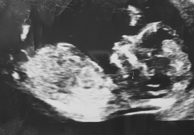 Beba je zaÄudila i lekare i roditelje