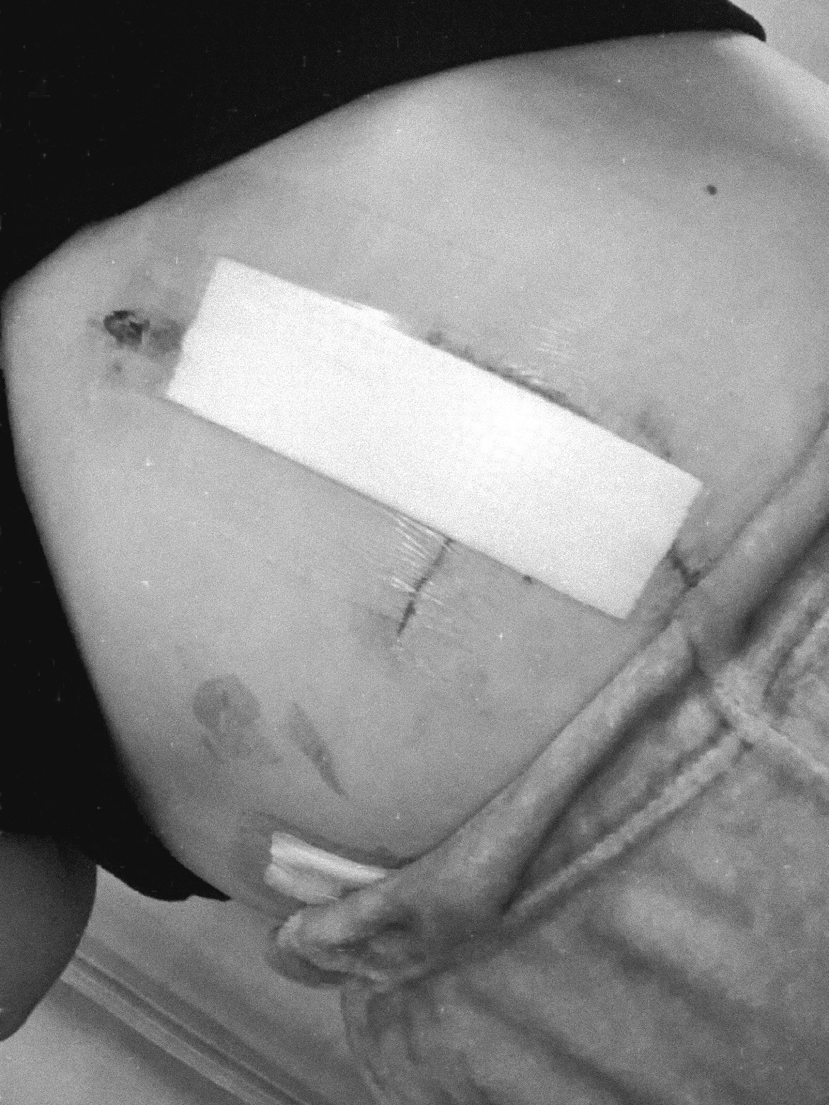 Bella Baylissová (25), začala pociťovať nafukovanie a bolesť žalúdka.