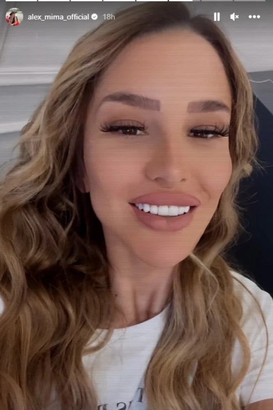 Novi zubi Aleksandre Nikolić