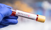 WHO: wykryto przypadek koronawirusa MERS-CoV. Zakażony 28-letni mężczyzna