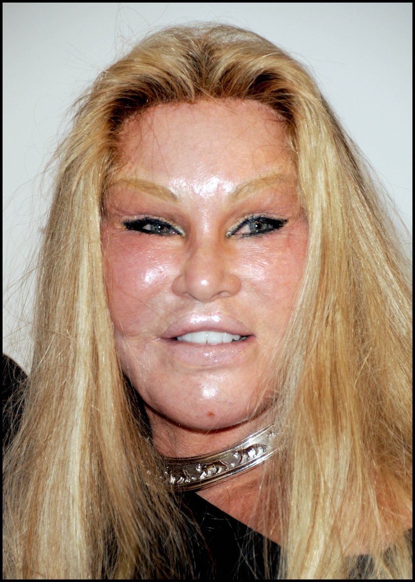 Jocelyn Wildenstein