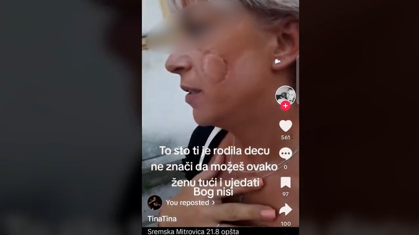 Napao i ujeo suprugu za obraz