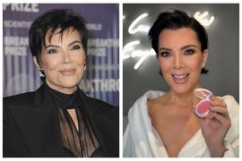 KRIS DŽENER na pragu 70. rođendana ima LICE ŽENE OD 35 GODINA! I ovaj HIRURG - ČAROBNJAK JE KRIV ZA TO: "Našla SVETI GRAL VEČNE MLADOSTI", transformacija za nevericu