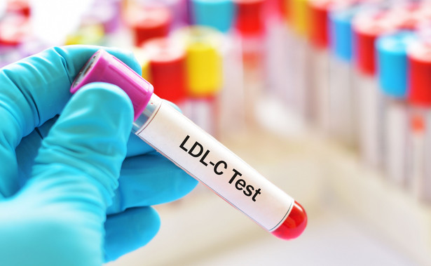 Cholesterol LDL