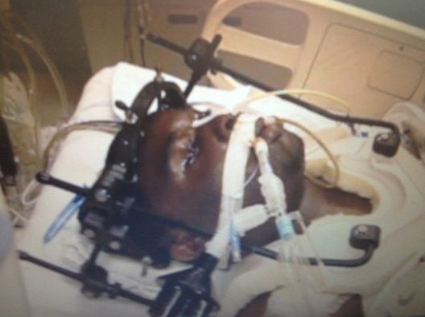 Da li će identifikacija treptanjem poslužiti kao dokaz?