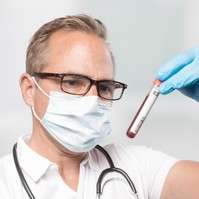 Szérum koleszterin: a szakorvos szerint ekkor már mindenképp csökkenteni kell