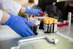 Ruszyła strona internetowa prezentująca codzienne raporty zakażeń