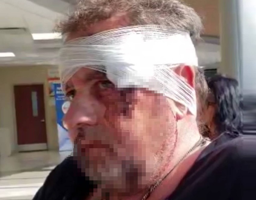 Pretučeni Vasilije Stanković