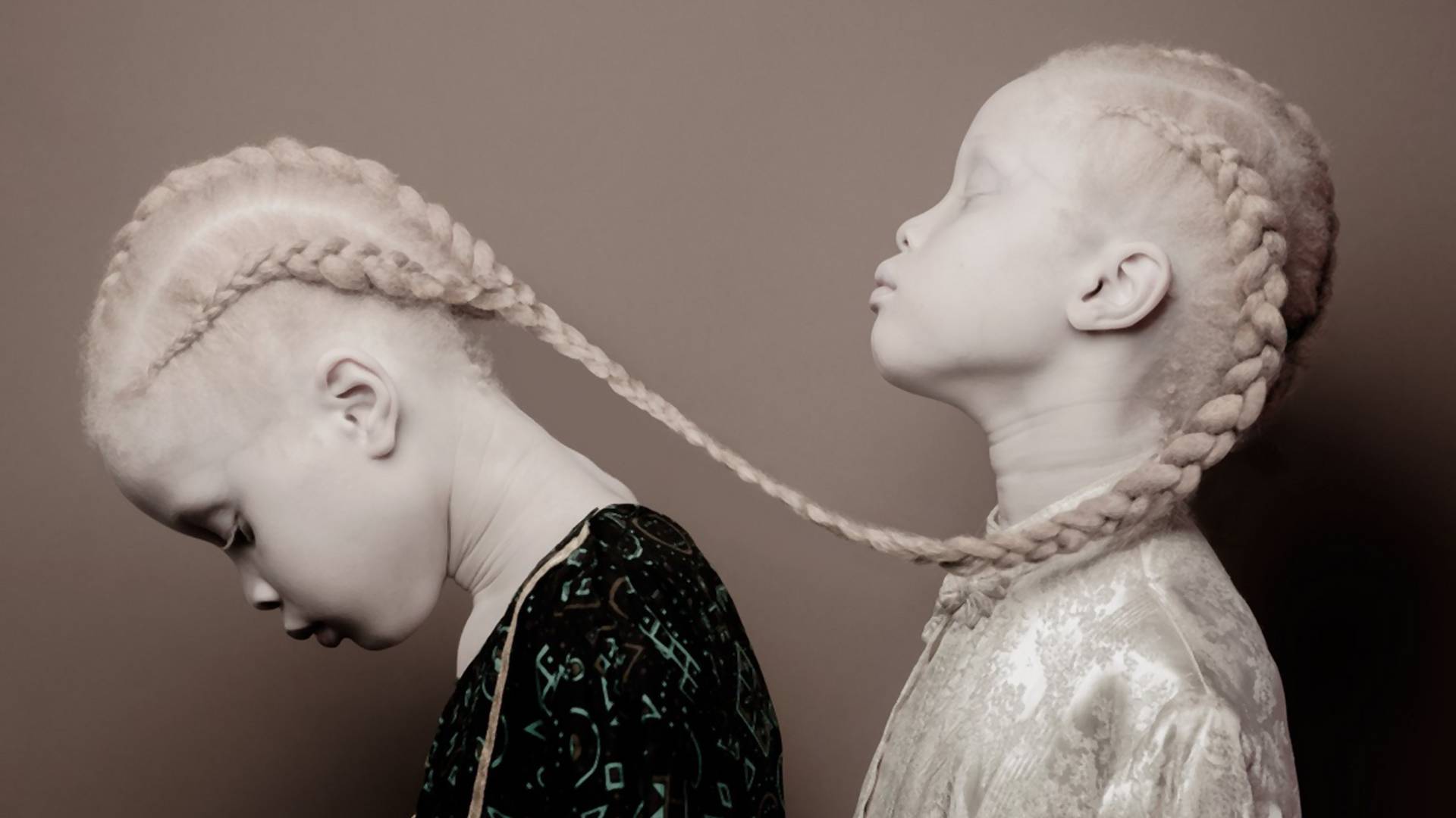 Albino bliznakinje jedinstvene lepote osvajaju svet mode