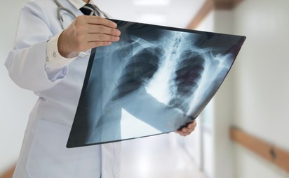 Az orvos elárulja, hogy mit tegyen a COPD-s beteg, ha fellángolnak a tünetei