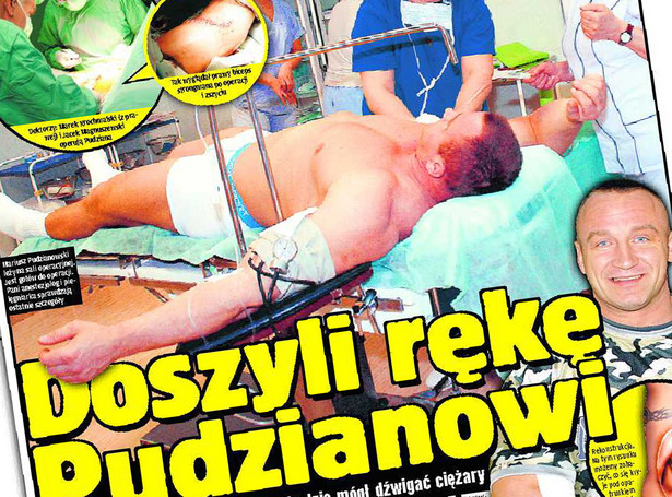 "Pudzian" widział, jak przyszywają mu rękę