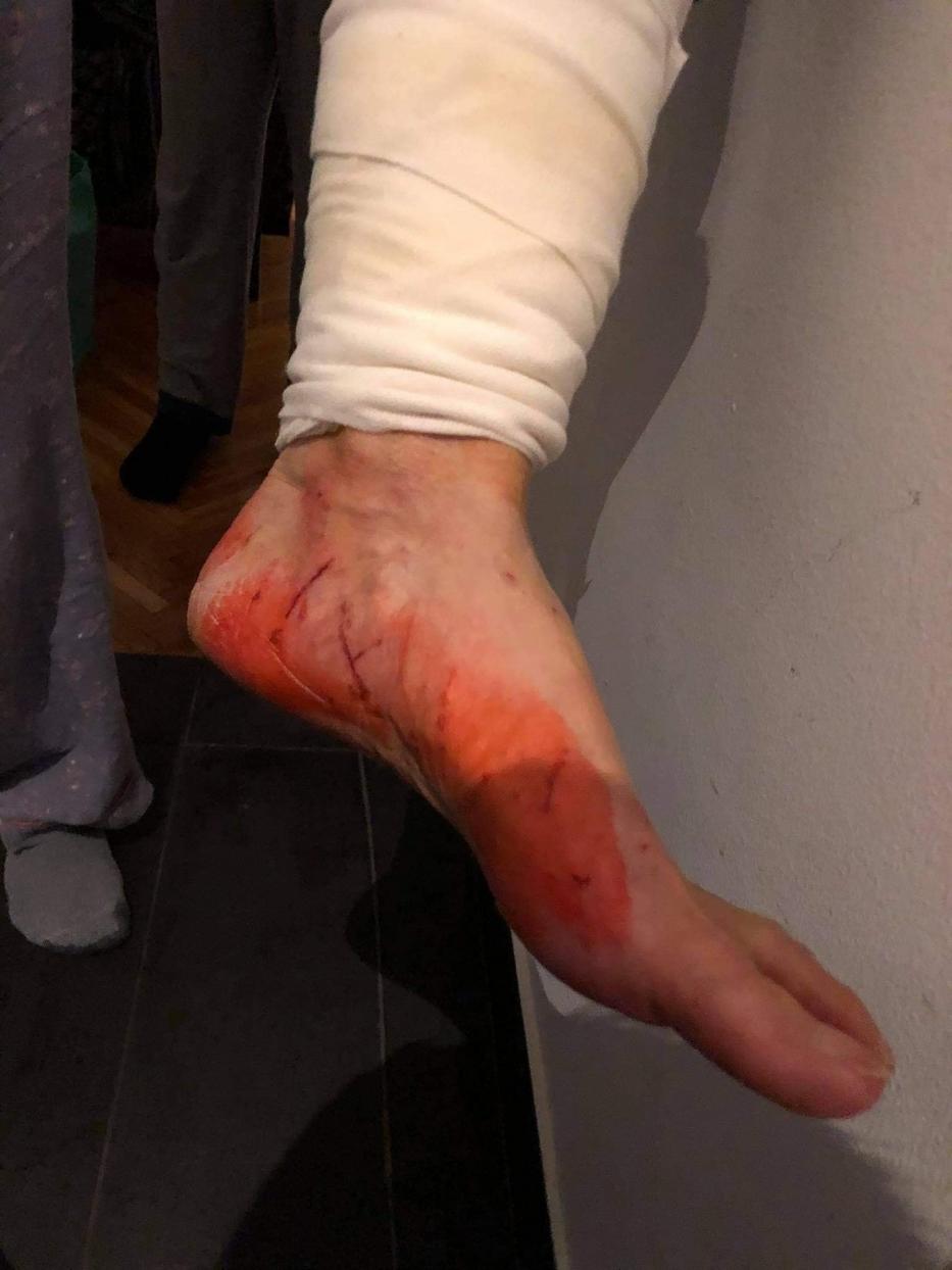 Az asszony lábát is véresre karmolta Lizi / Fotó: Facebook