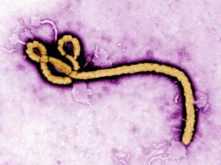 Wirus Ebola wirusy choroby zdrowie epidemie