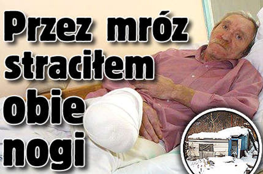 Przez mróz straciłem obie nogi