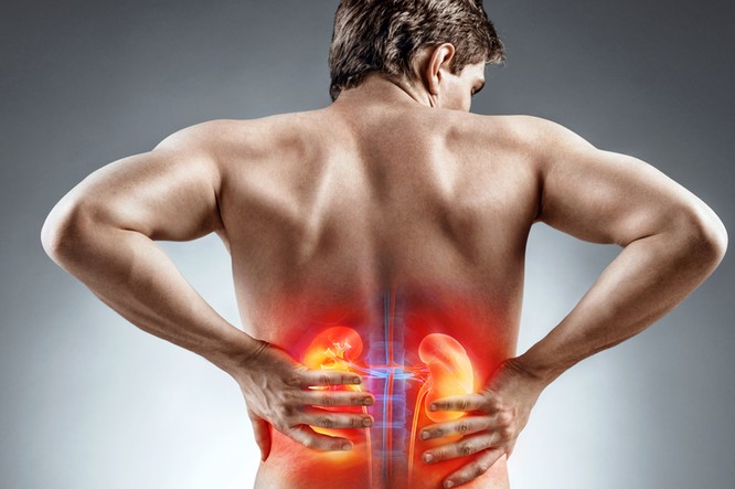 Nierensteine können heftige Koliken verursachen. Beim Verdacht auf die Erkrankung oder bei akuten Schmerzen sollte man einen Arzt aufsuchen.