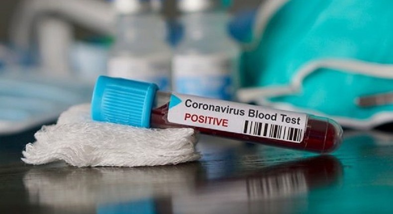 More than 110 health workers test positive for coronavirus in Central Region