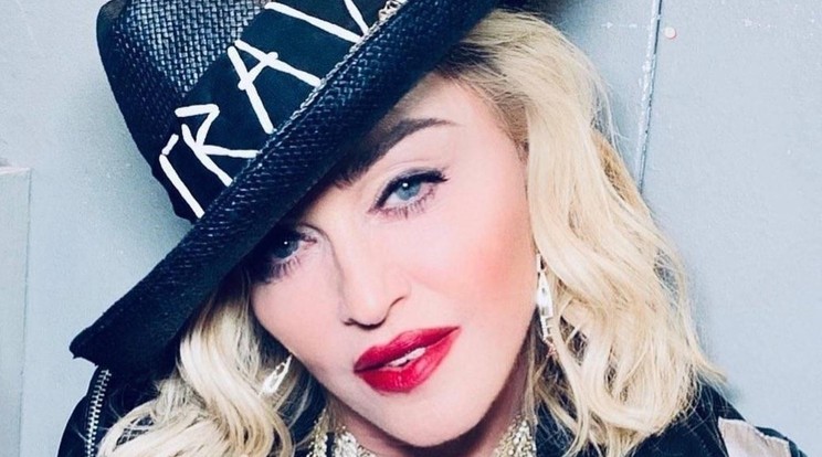 Madonna is zaklatás áldozata lett / Fotó: Northfoto