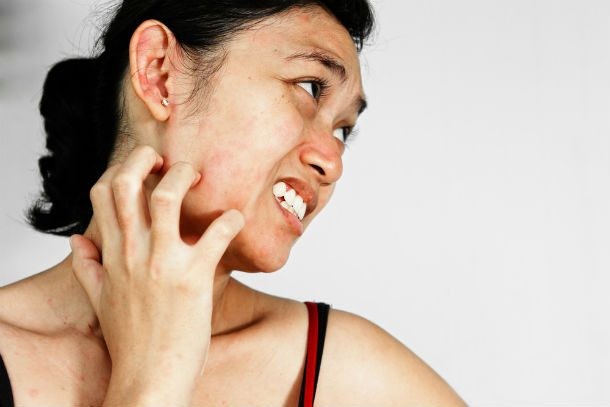 Prolonged lack of hygiene can cause your skin to harden [List25]