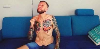 Uczestnik „Gogglebox” schudł ponad 140 kg. Pokazał zdjęcie brzucha