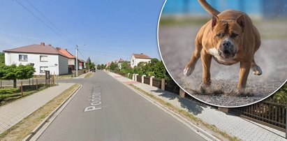 Dramat w Jarocinie. Agresywny amstaff rzucił się na 14-latkę. Jego łapy były całe we krwi