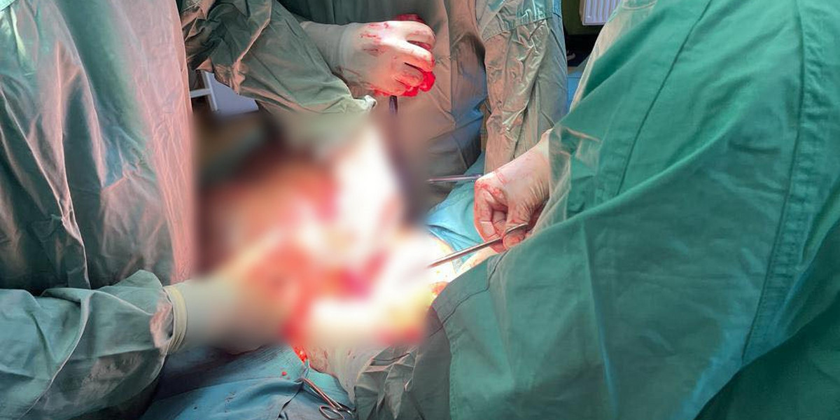 Lekarze podczas operacji wycięcia gigantycznego guza.