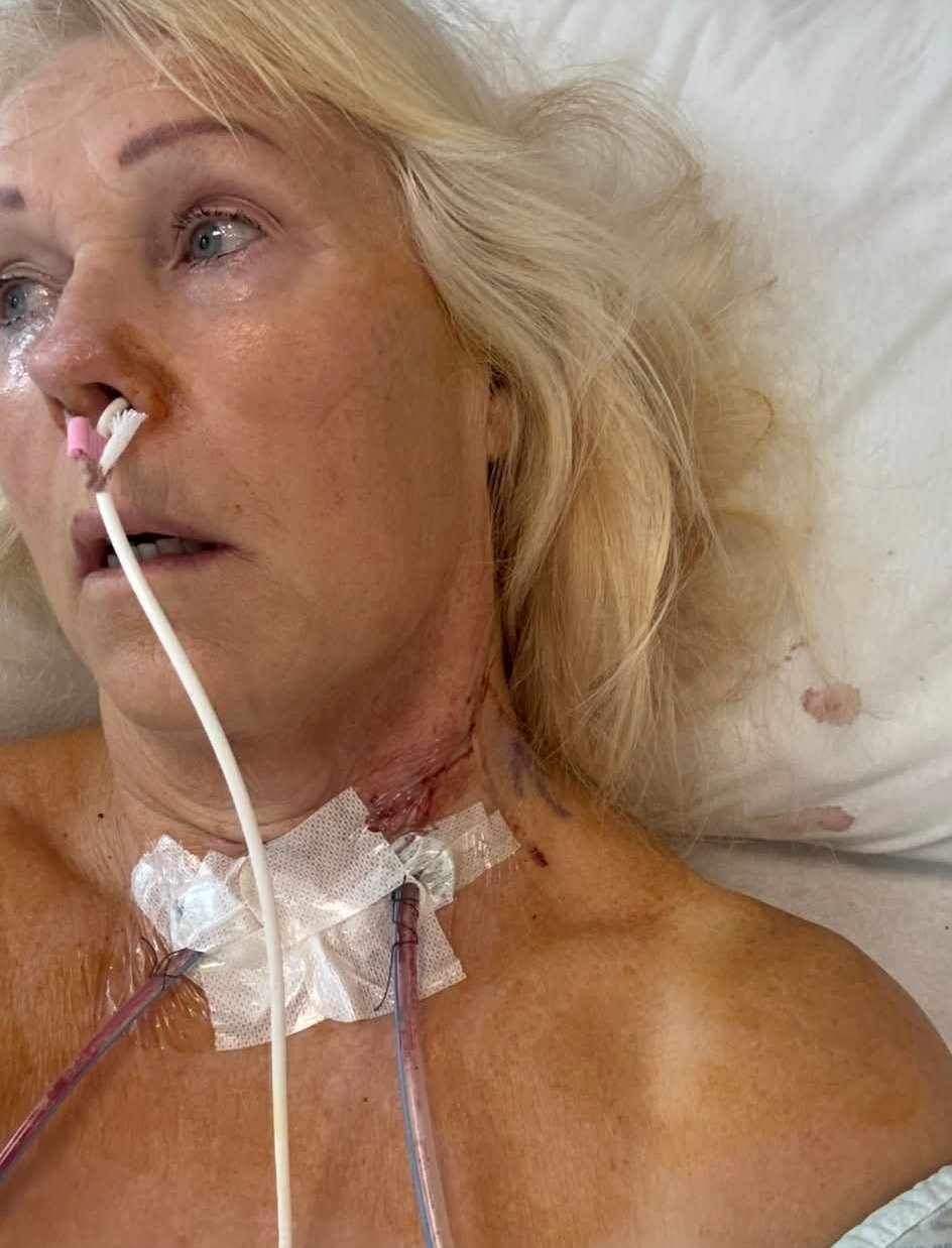 Lekári Margot diagnostikovali rakovinu jazyka.