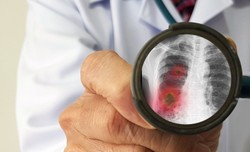 Koronawirus w Chinach. Wuhan chce przebadać wszystkich mieszkańców