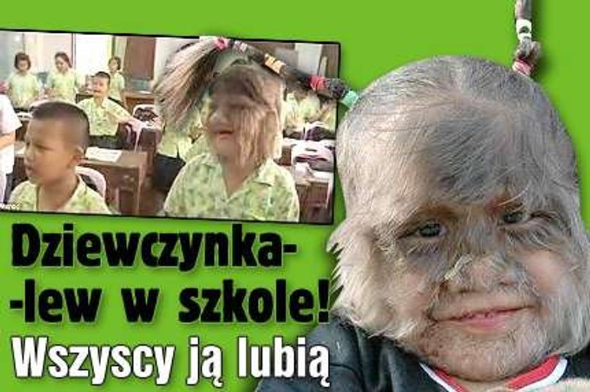 Dziewczynka-lew w szkole! Wszyscy ją lubią