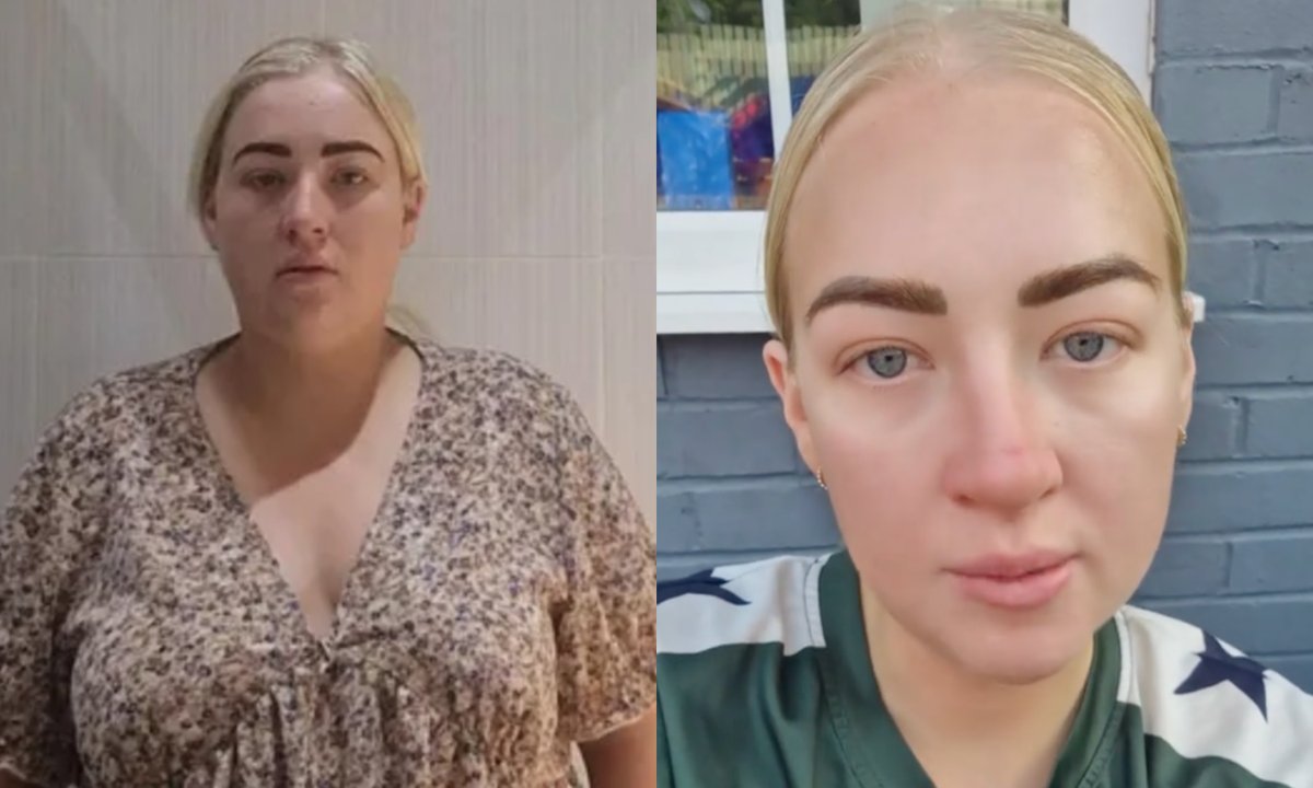 Schudła 38 kg dzięki lekowi na cukrzycę. "Teraz nago wyglądam gorzej"