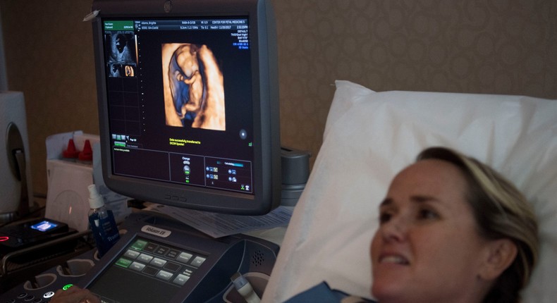 Brigitte Adams looks at an ultrasound of her pregnancy at the Center for Fetal Medicine in Los Angeles, CA. After her own frozen eggs failed, she is pregnant with a donor egg and donor sperm.