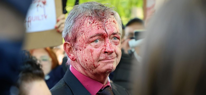 RMF: Jest śledztwo ws. oblania farbą ambasadora Rosji w Warszawie