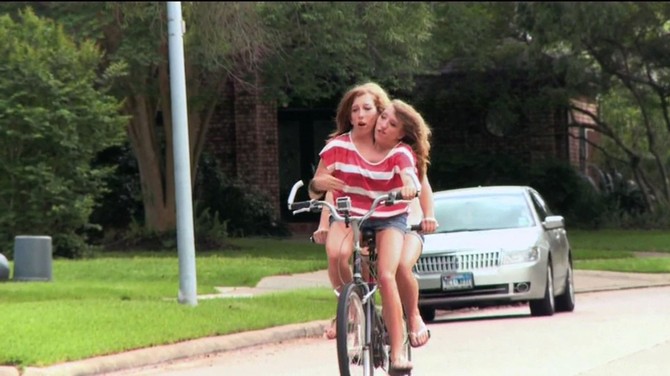 Ebi kontroliše desnu stranu tela, a Britani levu, i veoma im je teško da koordinišu pokrete