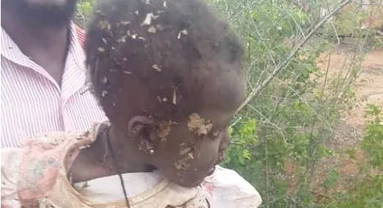 10-month-old baby girl rescued in Ghana after being buried alive by her mother