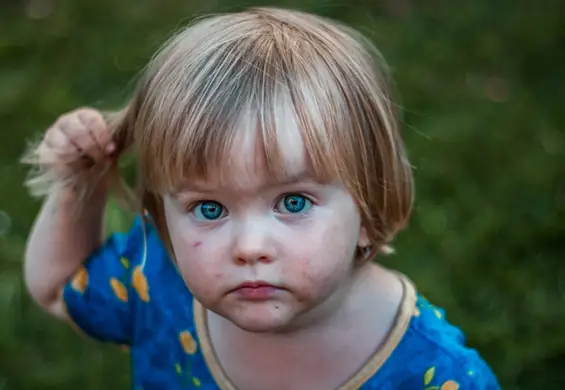 Dzieci w przedszkolach zakażone pasożytami. Sanepid ostrzega rodziców