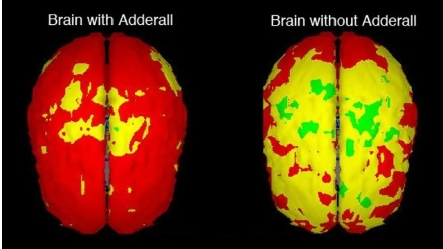 Oto skan mózgu - po lewej stonie na Adderallu,  po prawej bez niego; widać, jak bardzo wzmaga się praca tego najważniejszego narządu człowieka