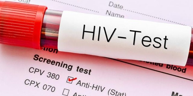 HIV test