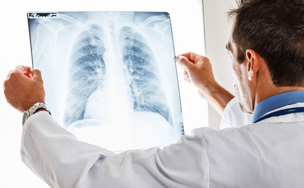 Agresywnego raka płuca można leczyć. Polska jednak wciąż w czołówce umieralności